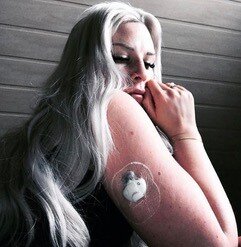 Jasmin Diabulimie mit Guardian Sensor