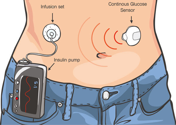 Zusammenspiel Pumpe und Sensor
