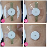 Overpatches Fixierpflaster XL - Transparent - 10 Stück