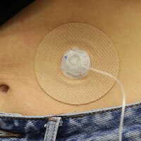 Katheterpflaster M (groß) - verschiedene Farben