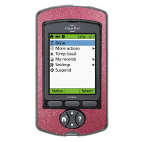 Omnipod PDM-Sticker - Rosa Glitzer